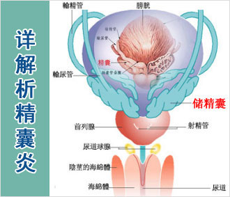 精囊炎是因为什么引起的