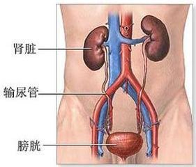 膀胱炎怎么治疗？